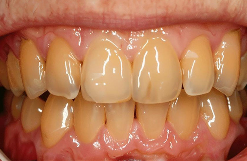 teeth-3